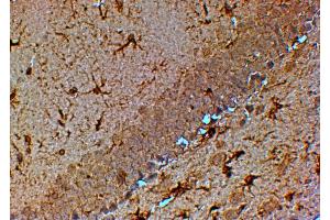 Image no. 2 for anti-Transient Receptor Potential Cation Channel, Subfamily M, Member 7 (TRPM7) (C-Term) antibody (ABIN184611)