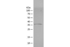MSTN Protein (AA 267-375) (IF2DI tag)
