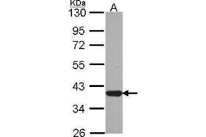 Image no. 1 for anti-Leucine Zipper Transcription Factor-Like 1 (LZTFL1) (Center) antibody (ABIN2855834)