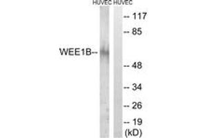 Image no. 1 for anti-WEE1 Homolog 2 (S. Pombe) (WEE2) (AA 151-200) antibody (ABIN1535466)