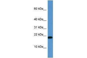 Image no. 2 for anti-SH2 Domain Containing 1A (SH2D1A) (C-Term) antibody (ABIN2788421)
