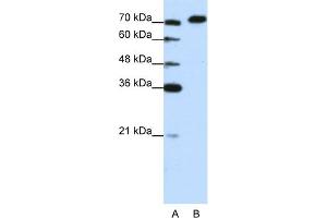 Image no. 1 for anti-A Kinase (PRKA) Anchor Protein 8-Like (AKAP8L) (C-Term) antibody (ABIN2780924)
