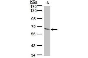 Image no. 1 for anti-Coagulation Factor XI (F11) (Center) antibody (ABIN2856233)
