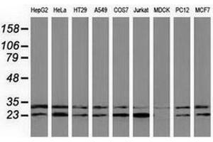 Western blot analysis of extracts (35 µg) from 9 different cell lines by using anti-CLPP monoclonal antibody.