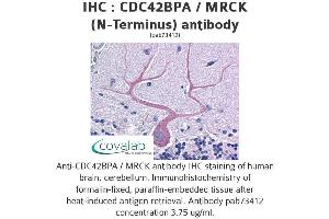 Image no. 1 for anti-CDC42 Binding Protein Kinase alpha (DMPK-Like) (CDC42BPA) (N-Term) antibody (ABIN1732910)