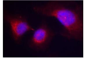 Image no. 2 for anti-Spleen tyrosine Kinase (SYK) (pTyr323) antibody (ABIN3020046)