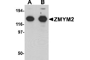 Image no. 1 for anti-Zinc Finger, MYM-Type 2 (ZMYM2) (C-Term) antibody (ABIN1030825)