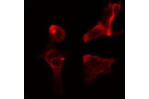 Image no. 1 for anti-Neuromedin B Receptor (NMBR) (Internal Region) antibody (ABIN6257386)