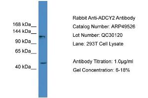 Image no. 2 for anti-Adenylate Cyclase 2 (Brain) (ADCY2) (Middle Region) antibody (ABIN2783791)