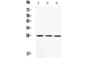 Image no. 2 for anti-Superoxide Dismutase 2, Mitochondrial (SOD2) (AA 45-62), (N-Term) antibody (ABIN3044165)