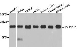 Image no. 1 for anti-NADH Dehydrogenase (Ubiquinone) 1 beta Subcomplex, 10, 22kDa (NDUFB10) antibody (ABIN6144472)