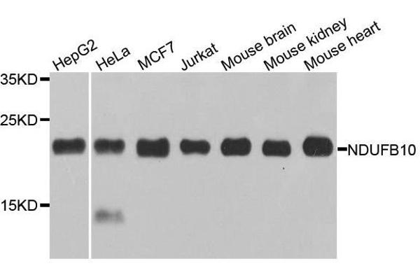 NDUFB10 抗体  (AA 1-172)