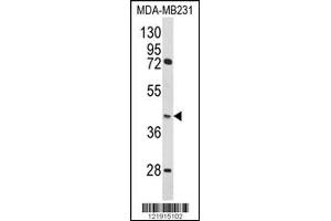 Image no. 1 for anti-Homer Homolog 3 (Drosophila) (HOMER3) antibody (ABIN2439695)
