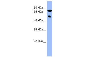 Image no. 1 for anti-Cytochrome P450, Family 11, Subfamily B, Polypeptide 2 (CYP11B2) (Middle Region) antibody (ABIN632030)