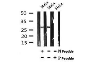 Image no. 1 for anti-SET Domain Containing 2 (SETD2) (pSer532) antibody (ABIN6269521)