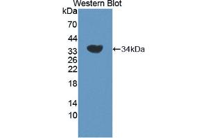 Image no. 1 for anti-Adrenergic, Beta, Receptor Kinase 2 (ADRBK2) (AA 191-453) antibody (ABIN5013093)