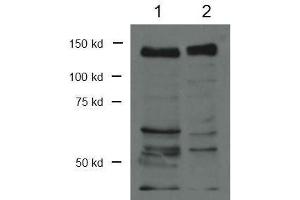 Image no. 2 for anti-CCCTC-Binding Factor (Zinc Finger Protein) (CTCF) (C-Term) antibody (ABIN964615)