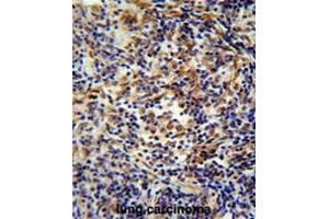 CASKIN2 antibody  (Middle Region)