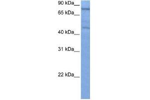 Image no. 1 for anti-Zinc Finger Protein 555 (ZNF555) (C-Term) antibody (ABIN927897)