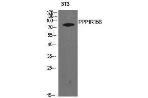 Image no. 1 for anti-Protein Phosphatase 1, Regulatory Subunit 15B (PPP1R15B) (Internal Region) antibody (ABIN3181424)