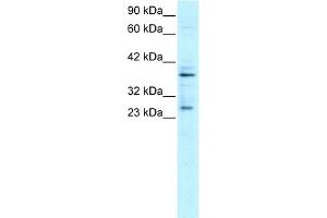 Image no. 2 for anti-Sirtuin 5 (SIRT5) (C-Term) antibody (ABIN2779612)