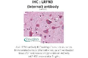 Image no. 1 for anti-Leucine Rich Repeat and Fibronectin Type III Domain Containing 3 (LRFN3) (Internal Region) antibody (ABIN1736556)