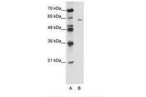 Image no. 1 for anti-BTB (POZ) Domain Containing 14A (BTBD14A) (AA 491-540) antibody (ABIN6736109)