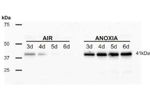 Image no. 2 for anti-Alcohol Dehydrogenase (ADH) antibody (ABIN619537)