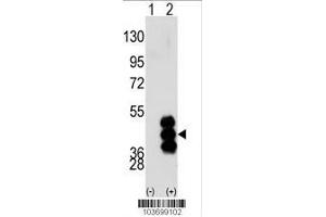Image no. 2 for anti-phosphorylase Kinase, gamma 2 (Testis) (PHKG2) (AA 41-71), (N-Term) antibody (ABIN391341)