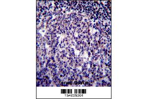 Image no. 4 for anti-Baculoviral IAP Repeat Containing 3 (BIRC3) (AA 59-88), (N-Term) antibody (ABIN657941)