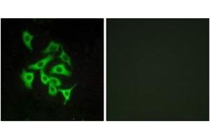 Immunofluorescence analysis of A549 cells, using GPR100 Antibody.