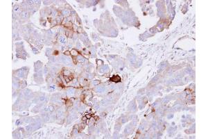 Image no. 2 for anti-Alkaline Phosphatase, Liver/bone/kidney (ALPL) (Center) antibody (ABIN2854870)