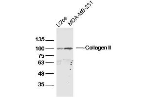 Image no. 1 for anti-Collagen, Type II (COL2) (AA 1401-1487) antibody (ABIN1387355)