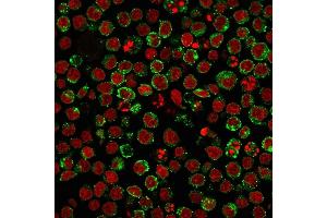 Image no. 4 for anti-MHC Class II HLA-DP/DQ/DR antibody (ABIN6941452)