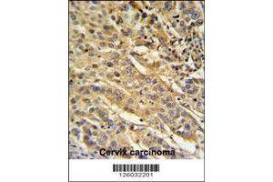 Immunohistochemistry (IHC) image for anti-Family with Sequence Similarity 91, Member A1 (FAM91A1) antibody (ABIN2158770)
