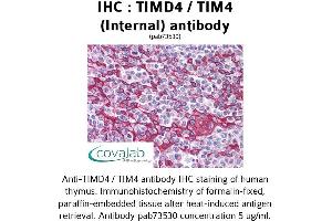 Image no. 2 for anti-T-Cell Immunoglobulin and Mucin Domain Containing 4 (TIMD4) (Internal Region) antibody (ABIN1740078)