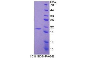 Image no. 1 for Nitric Oxide Synthase 2, Inducible (NOS2) (AA 530-693) protein (His tag) (ABIN1980849)