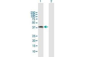 Image no. 3 for anti-Nephroblastoma Overexpressed (NOV) (AA 1-357) antibody (ABIN518408)