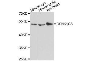 Image no. 1 for anti-Casein Kinase 1, gamma 3 (CSNK1G3) antibody (ABIN6139124)