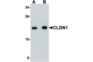 Image no. 1 for anti-Claudin 1 (CLDN1) (C-Term) antibody (ABIN6656160)