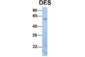 Image no. 4 for anti-Desmin (DES) (Middle Region) antibody (ABIN2776843)