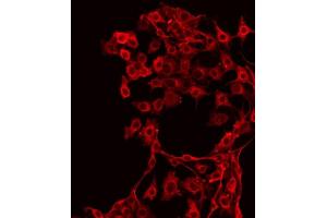 Image no. 2 for anti-Met Proto-Oncogene (MET) (pTyr1349) antibody (ABIN6255803)