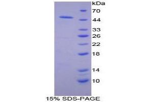 Image no. 4 for Adiponectin Receptor 2 (ADIPOR2) ELISA Kit (ABIN6730916)