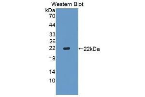 Image no. 1 for anti-Sex Hormone Binding Globulin (SHBG) (AA 53-214) antibody (ABIN1863145)