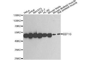 Image no. 2 for anti-Eukaryotic Translation Elongation Factor 1 gamma (EEF1G) antibody (ABIN3016525)