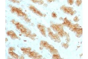 Image no. 3 for anti-Keratin Acidic (AE1) antibody (ABIN3023881)