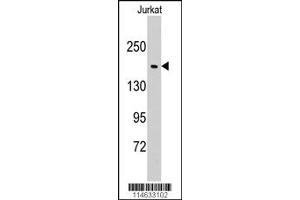 Western Blotting (WB) image for anti-Glutamyl-Prolyl-tRNA Synthetase (EPRS) antibody (ABIN2158726)