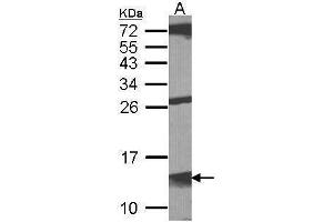 Image no. 4 for anti-Macrophage Migration Inhibitory Factor (Glycosylation-Inhibiting Factor) (MIF) (Center) antibody (ABIN2854957)