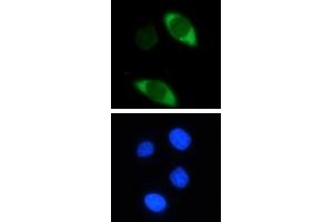Image no. 3 for anti-CRISPR-Cas9 (N-Term) antibody (ABIN6971496)