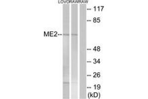 Image no. 1 for anti-NAD Dependent Malate Dehydrogenase (NAD-ME) (AA 201-250) antibody (ABIN1535055)